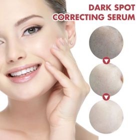 Hoygi Black Spot Repair Essence Lighten Skin Black Spot And Age Spot Moisturizing&Brightening Repair Essence (Essence: 1pcs)